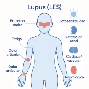 ¿El lupus se cura?