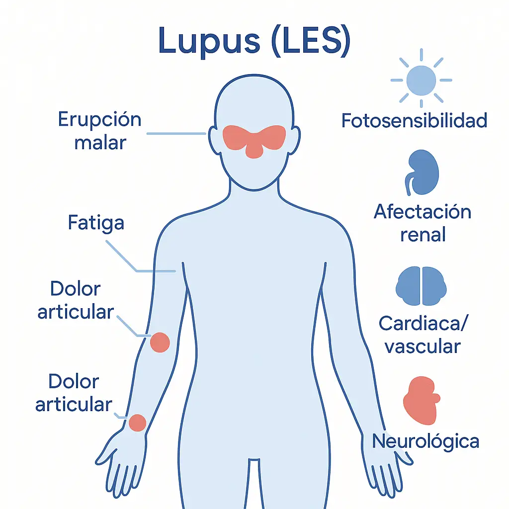 ¿El lupus se cura?